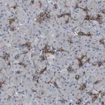 PREX2 Antibody in Immunohistochemistry (IHC)