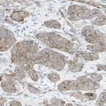 PREX2 Antibody in Immunohistochemistry (IHC)