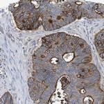 PREX2 Antibody in Immunohistochemistry (IHC)