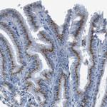 SLC35A3 Antibody in Immunohistochemistry (IHC)