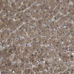 HADHA Antibody in Immunohistochemistry (IHC)