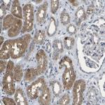 HADHA Antibody in Immunohistochemistry (IHC)