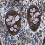 WNK2 Antibody in Immunohistochemistry (IHC)