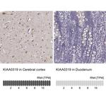 Kiaa0319 Antibody