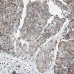 Bif1 Antibody in Immunohistochemistry (IHC)