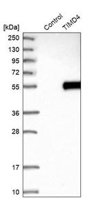 TIMD4 Antibody in Western Blot (WB)