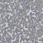 AFAP Antibody in Immunohistochemistry (IHC)