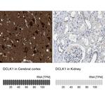 DCLK1 Antibody in Immunohistochemistry (IHC)