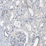 DCLK1 Antibody in Immunohistochemistry (IHC)