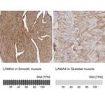 Laminin alpha-4 Antibody in Immunohistochemistry (IHC)