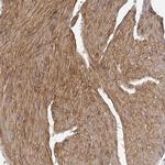 Laminin alpha-4 Antibody in Immunohistochemistry (IHC)