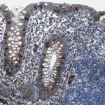 PDZD8 Antibody in Immunohistochemistry (IHC)