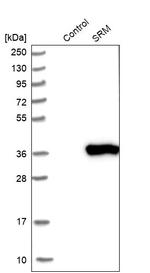 SRM Antibody in Western Blot (WB)