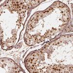 NSD2 Antibody in Immunohistochemistry (IHC)