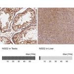 NSD2 Antibody