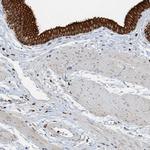 SH3D19 Antibody in Immunohistochemistry (IHC)