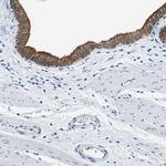 TAUT Antibody in Immunohistochemistry (IHC)