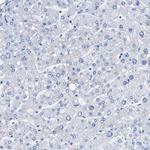 TAUT Antibody in Immunohistochemistry (IHC)