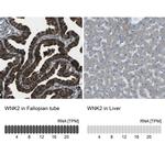 WNK2 Antibody