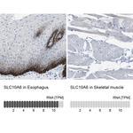 SLC10A6 Antibody