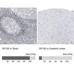 SP100 Antibody in Immunohistochemistry (IHC)