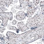 SP100 Antibody in Immunohistochemistry (IHC)