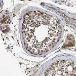 SLC15A4 Antibody in Immunohistochemistry (IHC)