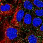 SLC16A10 Antibody in Immunocytochemistry (ICC/IF)