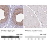 P4HA2 Antibody