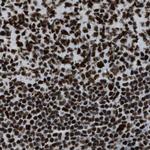 ZNF207 Antibody in Immunohistochemistry (IHC)