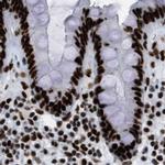 ZNF207 Antibody in Immunohistochemistry (IHC)