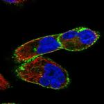 Dysferlin Antibody in Immunocytochemistry (ICC/IF)