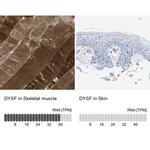 Dysferlin Antibody in Immunohistochemistry (IHC)