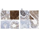 Dysferlin Antibody in Immunohistochemistry (IHC)