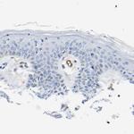 Dysferlin Antibody in Immunohistochemistry (IHC)