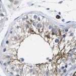 Dysferlin Antibody in Immunohistochemistry (IHC)