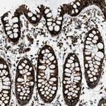 SQRDL Antibody in Immunohistochemistry (IHC)