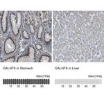 GALNT6 Antibody in Immunohistochemistry (IHC)