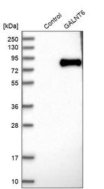 GALNT6 Antibody in Western Blot (WB)