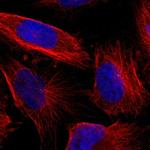 LGI2 Antibody in Immunocytochemistry (ICC/IF)