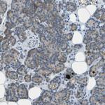 LGI2 Antibody in Immunohistochemistry (IHC)