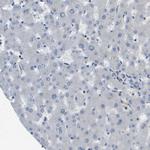 SCN4B Antibody in Immunohistochemistry (IHC)