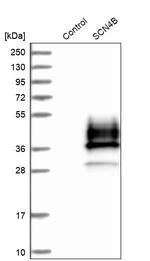 SCN4B Antibody in Western Blot (WB)