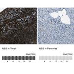 ABI3 Antibody in Immunohistochemistry (IHC)