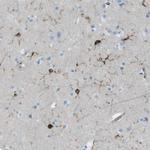 ABI3 Antibody in Immunohistochemistry (IHC)