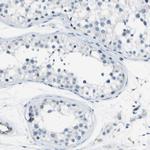 ABI3 Antibody in Immunohistochemistry (IHC)