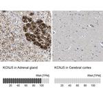 Kir3.4 (KCNJ5) Antibody in Immunohistochemistry (IHC)