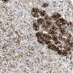 Kir3.4 (KCNJ5) Antibody in Immunohistochemistry (IHC)