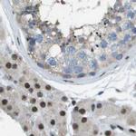 SP100 Antibody in Immunohistochemistry (IHC)