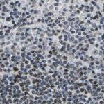 SP100 Antibody in Immunohistochemistry (IHC)